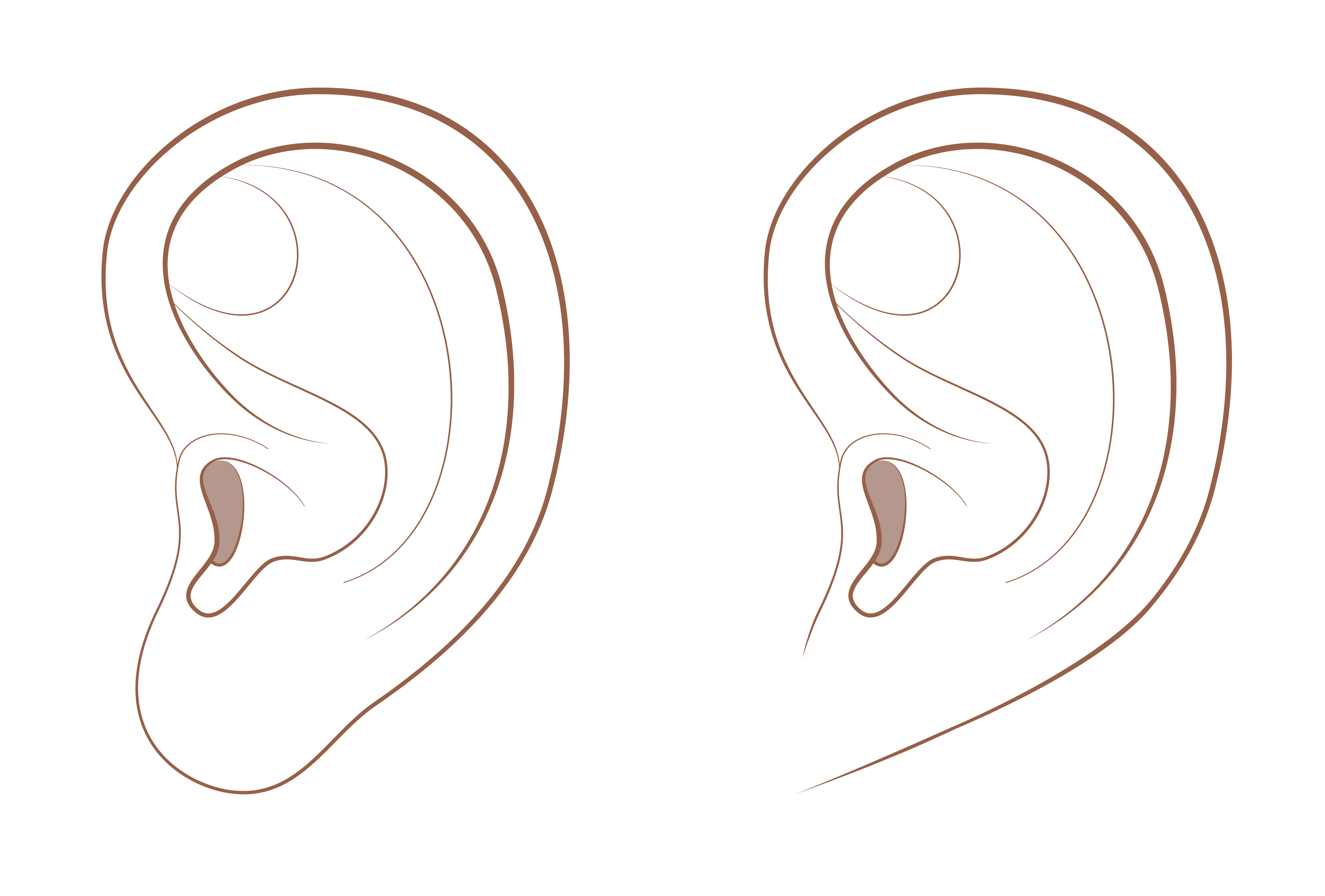 Comparing Different MRI Hearing Protection